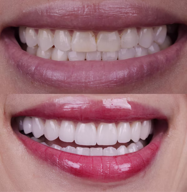 Patient with a confident, bright smile